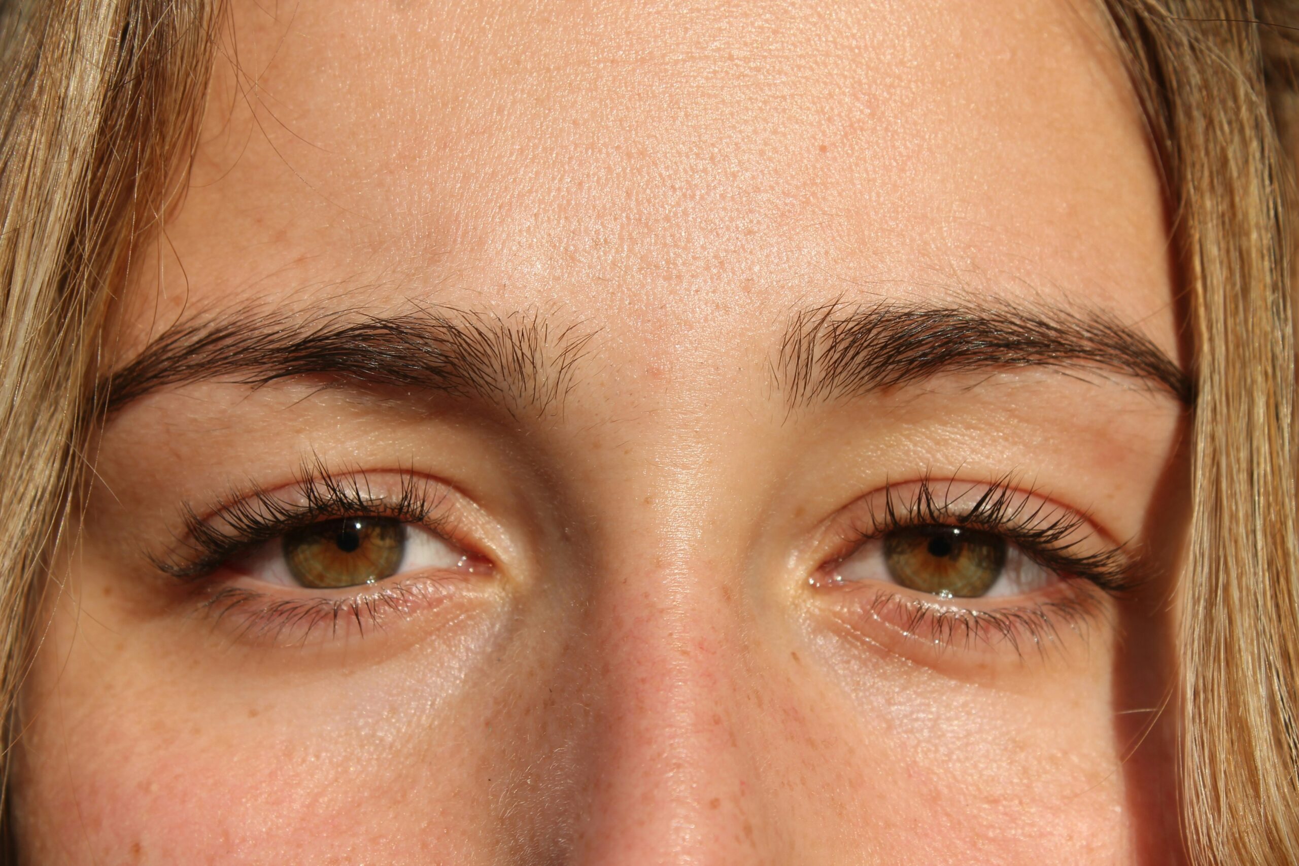 How Do You Get Rid of a Stye in 5 Minutes? featuring warm compresses, eyelid care, fast symptom relief, eye hygiene, and safe treatment methods.
